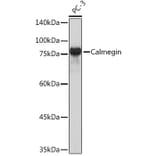 Western Blot - Anti-Calmegin Antibody [ARC2214] (A305871) - Antibodies.com