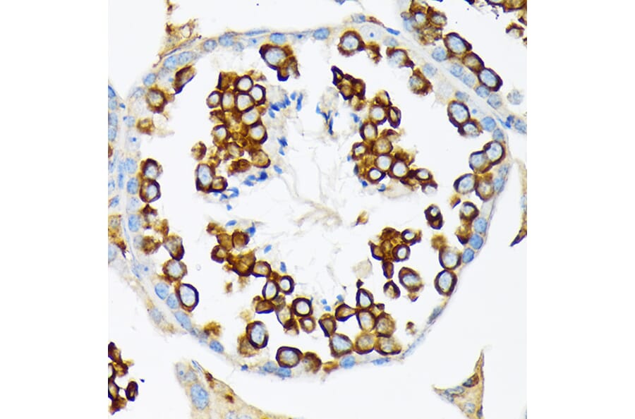 Immunohistochemistry - Anti-Calmegin Antibody [ARC2214] (A305871) - Antibodies.com