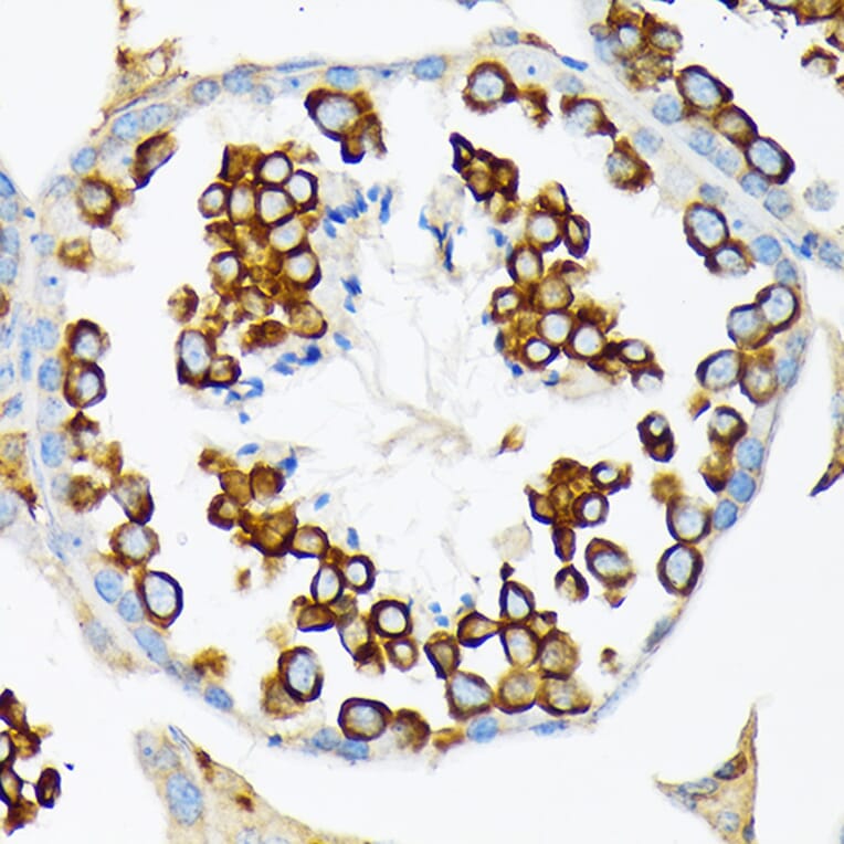 Immunohistochemistry - Anti-Calmegin Antibody [ARC2214] (A305871) - Antibodies.com