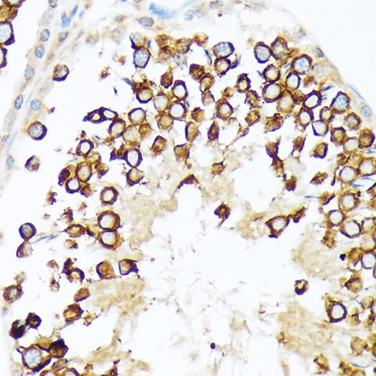 Immunohistochemistry - Anti-Calmegin Antibody [ARC2214] (A305871) - Antibodies.com