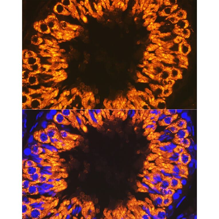 Immunofluorescence - Anti-Calmegin Antibody [ARC2214] (A305871) - Antibodies.com