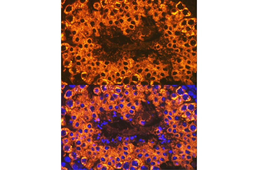 Immunofluorescence - Anti-Calmegin Antibody [ARC2214] (A305871) - Antibodies.com