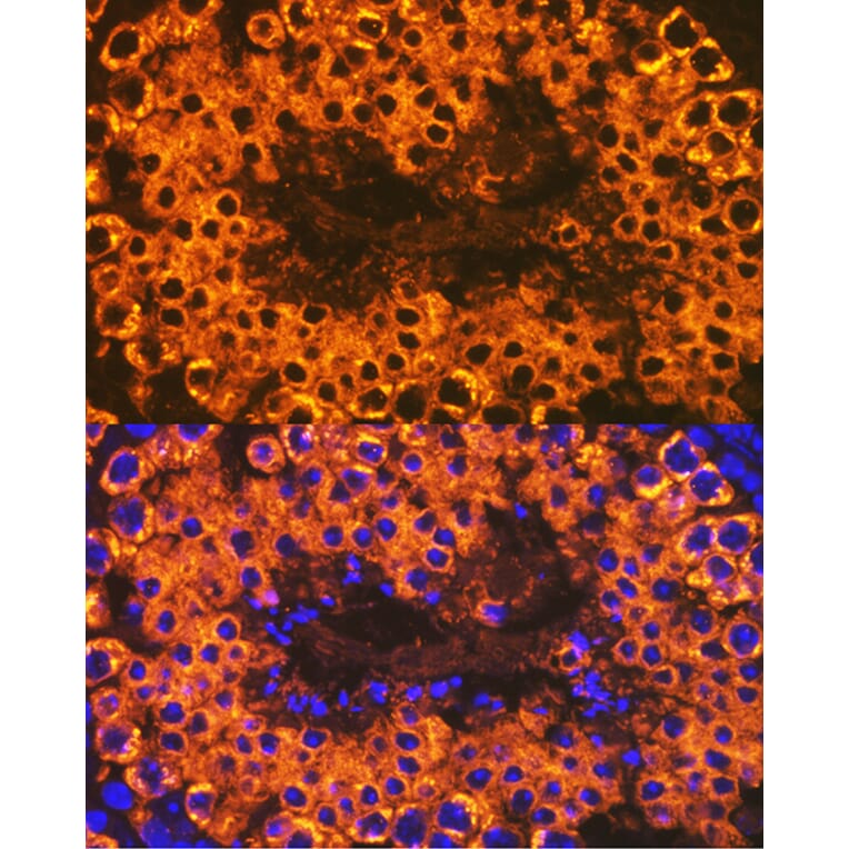 Immunofluorescence - Anti-Calmegin Antibody [ARC2214] (A305871) - Antibodies.com