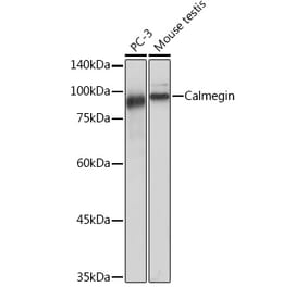Western Blot - Anti-Calmegin Antibody [ARC2213] (A305872) - Antibodies.com