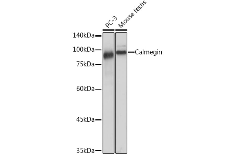 Western Blot - Anti-Calmegin Antibody [ARC2213] (A305872) - Antibodies.com