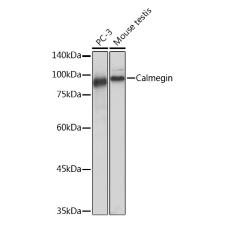 Western Blot - Anti-Calmegin Antibody [ARC2213] (A305872) - Antibodies.com