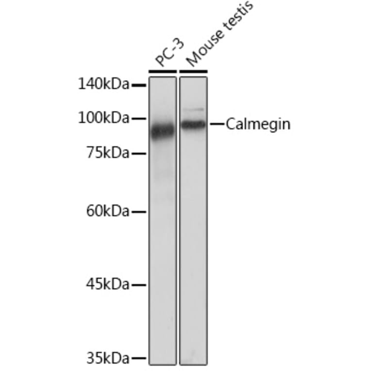Western Blot - Anti-Calmegin Antibody [ARC2213] (A305872) - Antibodies.com