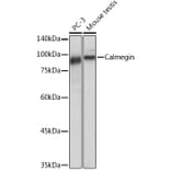 Western Blot - Anti-Calmegin Antibody [ARC2213] (A305872) - Antibodies.com