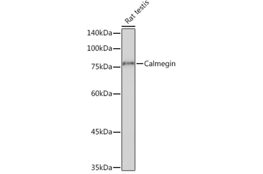 Western Blot - Anti-Calmegin Antibody [ARC2213] (A305872) - Antibodies.com