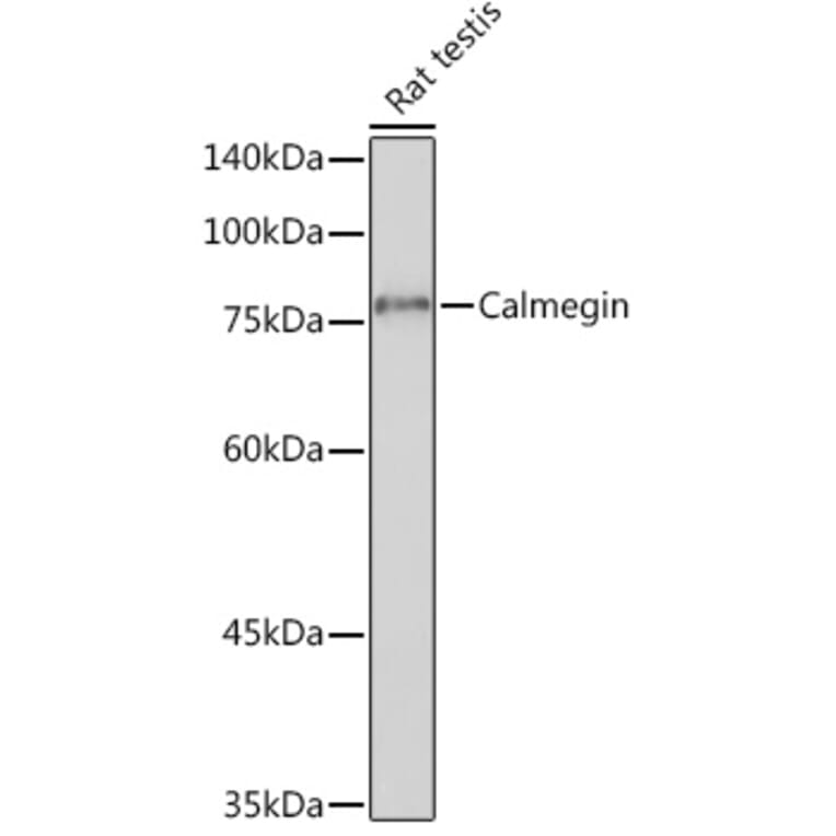 Western Blot - Anti-Calmegin Antibody [ARC2213] (A305872) - Antibodies.com