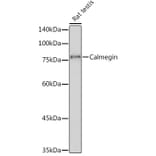 Western Blot - Anti-Calmegin Antibody [ARC2213] (A305872) - Antibodies.com