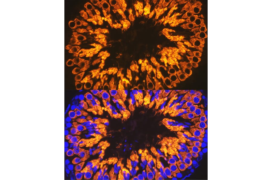 Immunofluorescence - Anti-Calmegin Antibody [ARC2213] (A305872) - Antibodies.com
