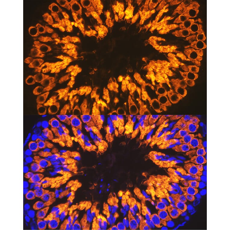 Immunofluorescence - Anti-Calmegin Antibody [ARC2213] (A305872) - Antibodies.com