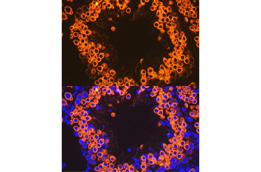 Immunofluorescence - Anti-Calmegin Antibody [ARC2213] (A305872) - Antibodies.com