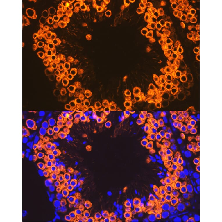 Immunofluorescence - Anti-Calmegin Antibody [ARC2213] (A305872) - Antibodies.com