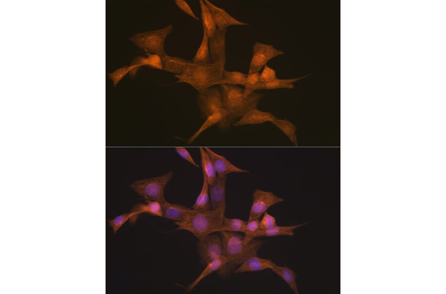 Immunofluorescence - Anti-Nesprin1/Syne-1 Antibody [ARC2307] (A305873) - Antibodies.com