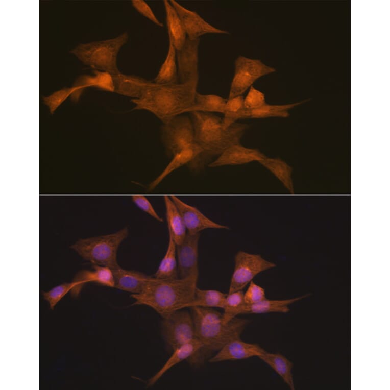 Immunofluorescence - Anti-Nesprin1/Syne-1 Antibody [ARC2307] (A305873) - Antibodies.com