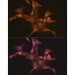 Immunofluorescence - Anti-Nesprin1/Syne-1 Antibody [ARC2307] (A305873) - Antibodies.com