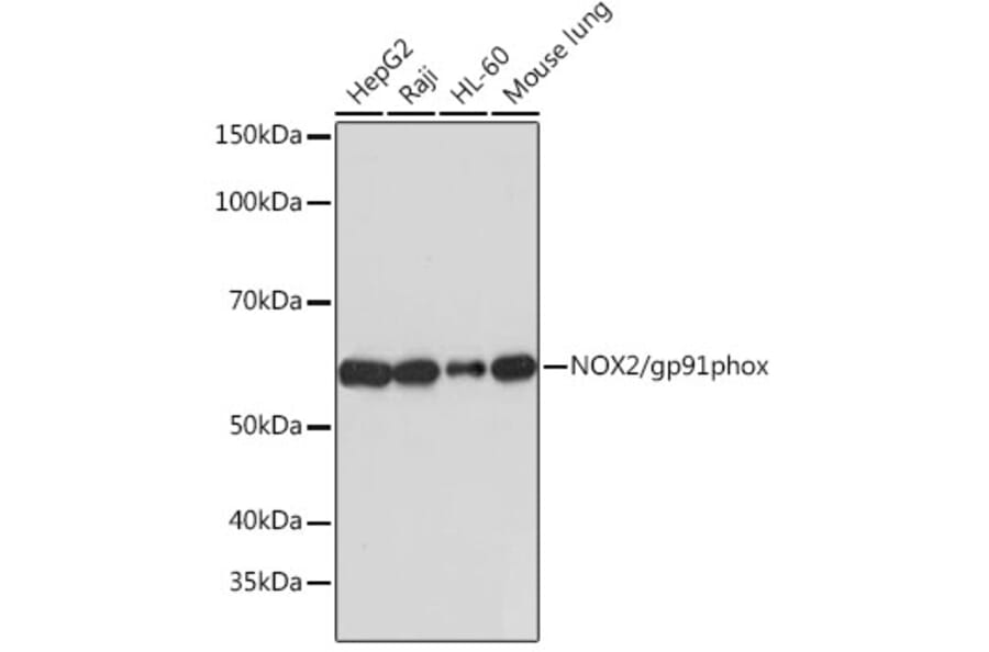 Western Blot - Anti-NOX2/gp91phox Antibody [ARC0181] (A305874) - Antibodies.com