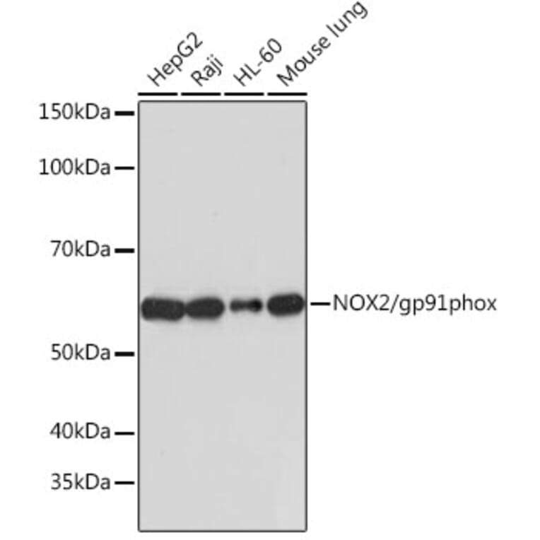 Western Blot - Anti-NOX2/gp91phox Antibody [ARC0181] (A305874) - Antibodies.com