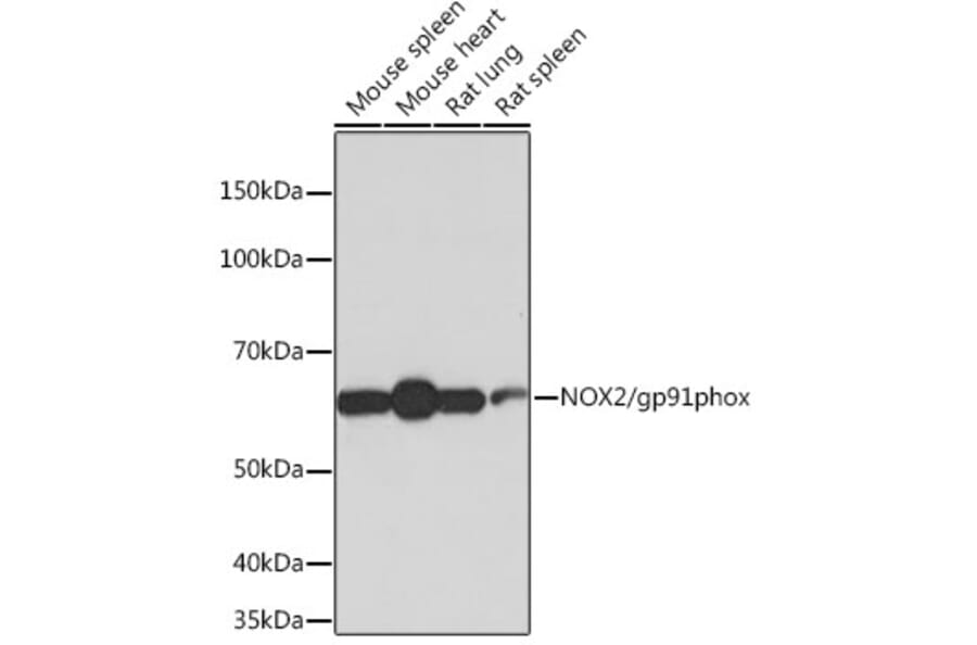 Western Blot - Anti-NOX2/gp91phox Antibody [ARC0181] (A305874) - Antibodies.com