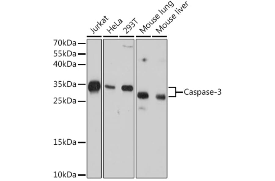 Western Blot - Anti-Caspase-3 Antibody [AMC0214] (A305875) - Antibodies.com