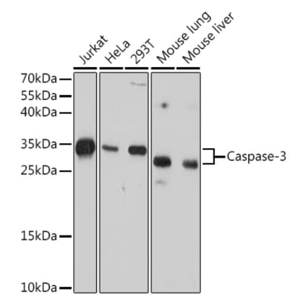 Western Blot - Anti-Caspase-3 Antibody [AMC0214] (A305875) - Antibodies.com