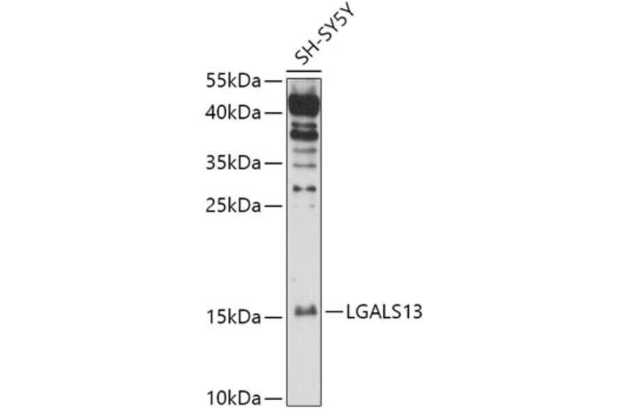 Western Blot - Anti-Galectin 13/PLAC8 Antibody (A305877) - Antibodies.com