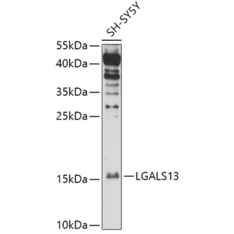 Western Blot - Anti-Galectin 13/PLAC8 Antibody (A305877) - Antibodies.com