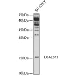 Western Blot - Anti-Galectin 13/PLAC8 Antibody (A305877) - Antibodies.com