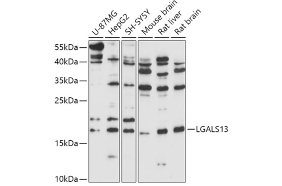 Western Blot - Anti-Galectin 13/PLAC8 Antibody (A305878) - Antibodies.com