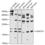 Western Blot - Anti-Galectin 13/PLAC8 Antibody (A305878) - Antibodies.com