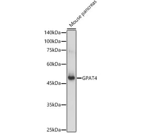Western Blot - Anti-GPAT4 Antibody (A305880) - Antibodies.com