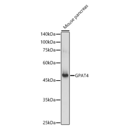Western Blot - Anti-GPAT4 Antibody (A305880) - Antibodies.com