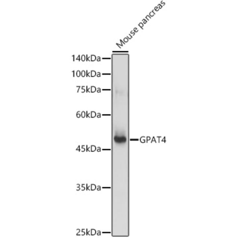 Western Blot - Anti-GPAT4 Antibody (A305880) - Antibodies.com