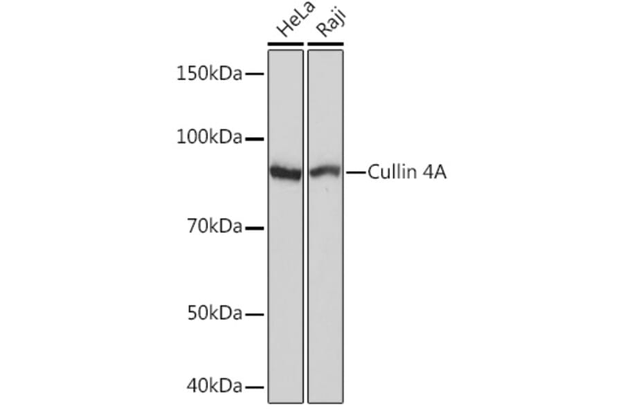 Western Blot - Anti-Cullin 4A/CUL-4A Antibody [ARC1237] (A305881) - Antibodies.com