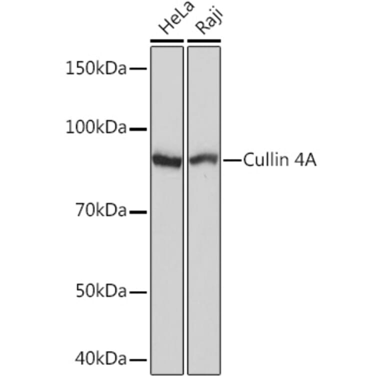 Western Blot - Anti-Cullin 4A/CUL-4A Antibody [ARC1237] (A305881) - Antibodies.com