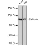 Western Blot - Anti-Cullin 4A/CUL-4A Antibody [ARC1237] (A305881) - Antibodies.com
