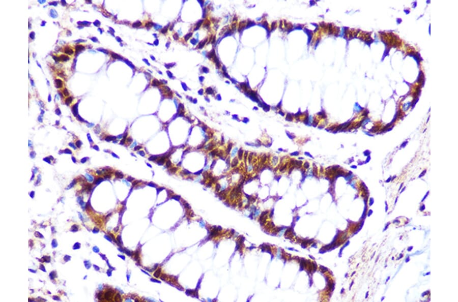 Immunohistochemistry - Anti-Cullin 4A/CUL-4A Antibody [ARC1237] (A305881) - Antibodies.com