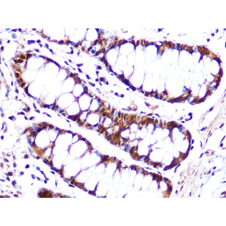 Immunohistochemistry - Anti-Cullin 4A/CUL-4A Antibody [ARC1237] (A305881) - Antibodies.com
