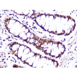 Immunohistochemistry - Anti-Cullin 4A/CUL-4A Antibody [ARC1237] (A305881) - Antibodies.com
