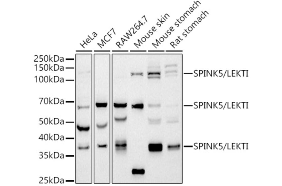Western Blot - Anti-SPINK5/LEKTI Antibody [ARC2888] (A305882) - Antibodies.com