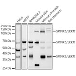 Western Blot - Anti-SPINK5/LEKTI Antibody [ARC2888] (A305882) - Antibodies.com