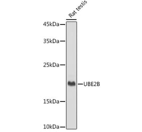 Western Blot - Anti-Ube2B Antibody [ARC2512] (A305883) - Antibodies.com
