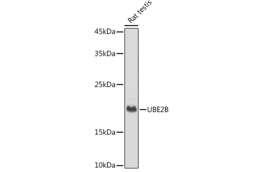 Western Blot - Anti-Ube2B Antibody [ARC2512] (A305883) - Antibodies.com