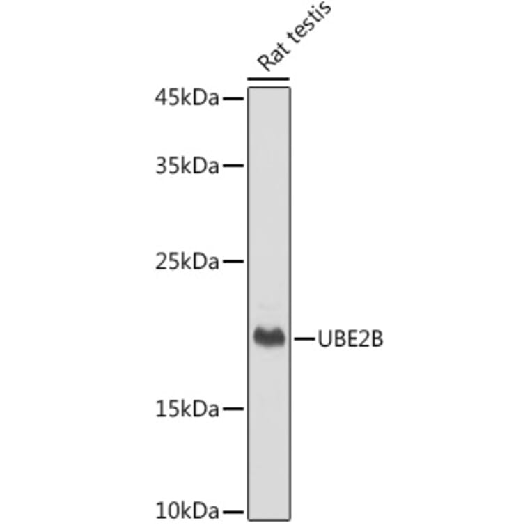 Western Blot - Anti-Ube2B Antibody [ARC2512] (A305883) - Antibodies.com