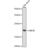 Western Blot - Anti-Ube2B Antibody [ARC2512] (A305883) - Antibodies.com