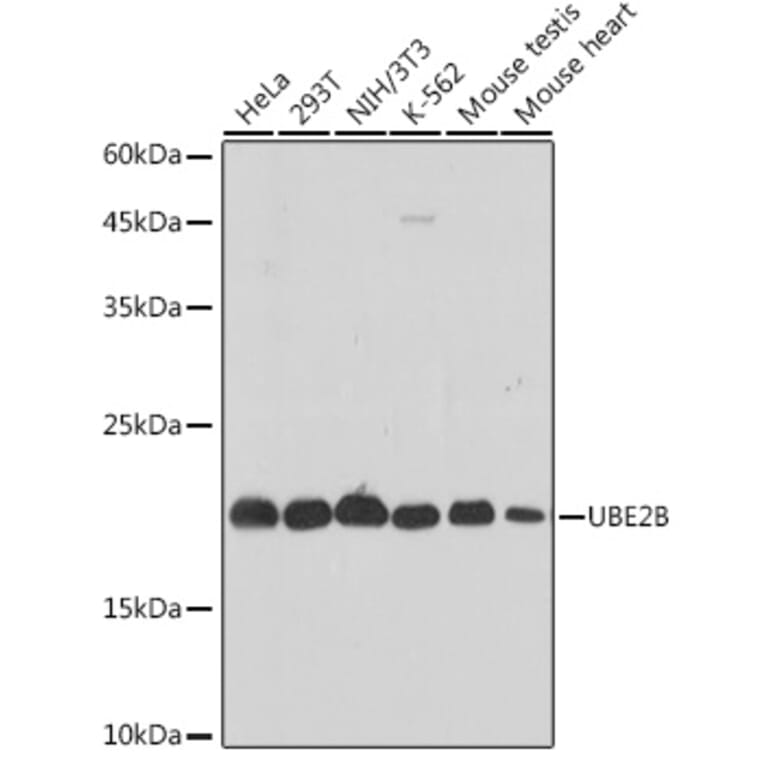 Western Blot - Anti-Ube2B Antibody [ARC2512] (A305883) - Antibodies.com