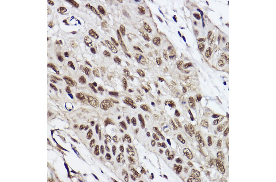 Immunohistochemistry - Anti-Ube2B Antibody [ARC2512] (A305883) - Antibodies.com