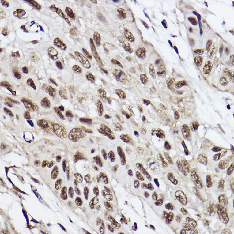 Immunohistochemistry - Anti-Ube2B Antibody [ARC2512] (A305883) - Antibodies.com
